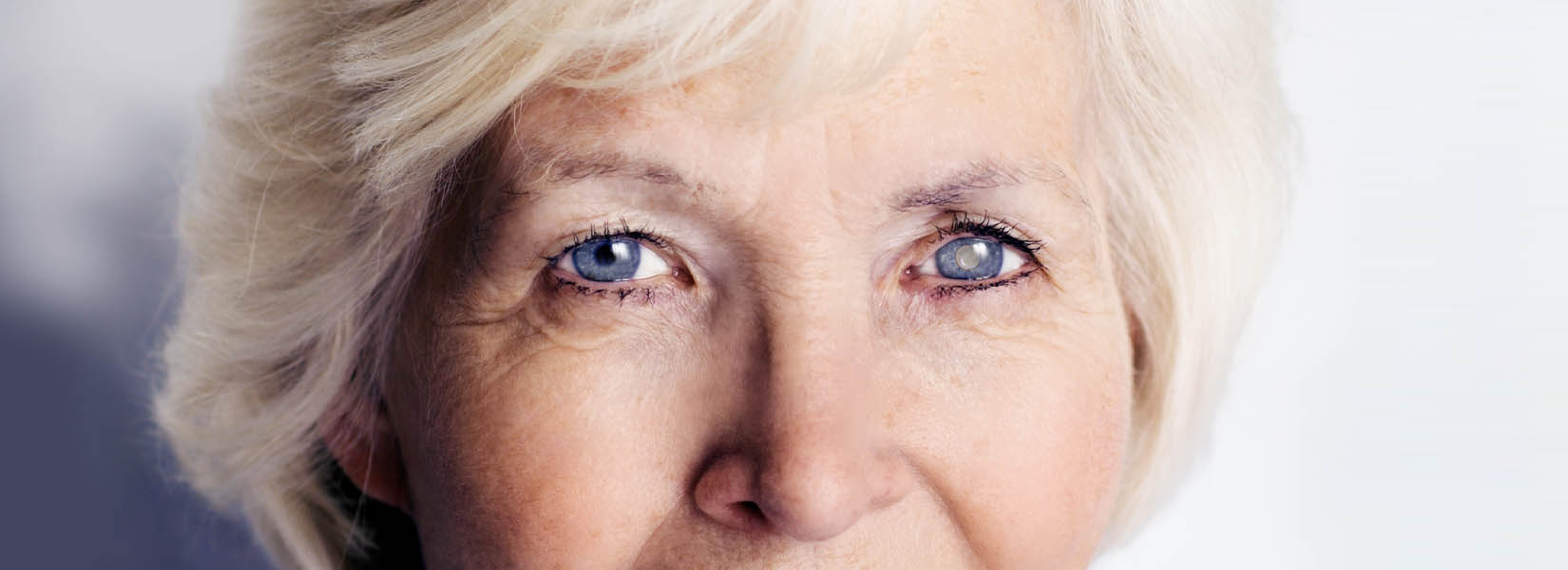 Cataract Surgery in Shadyside